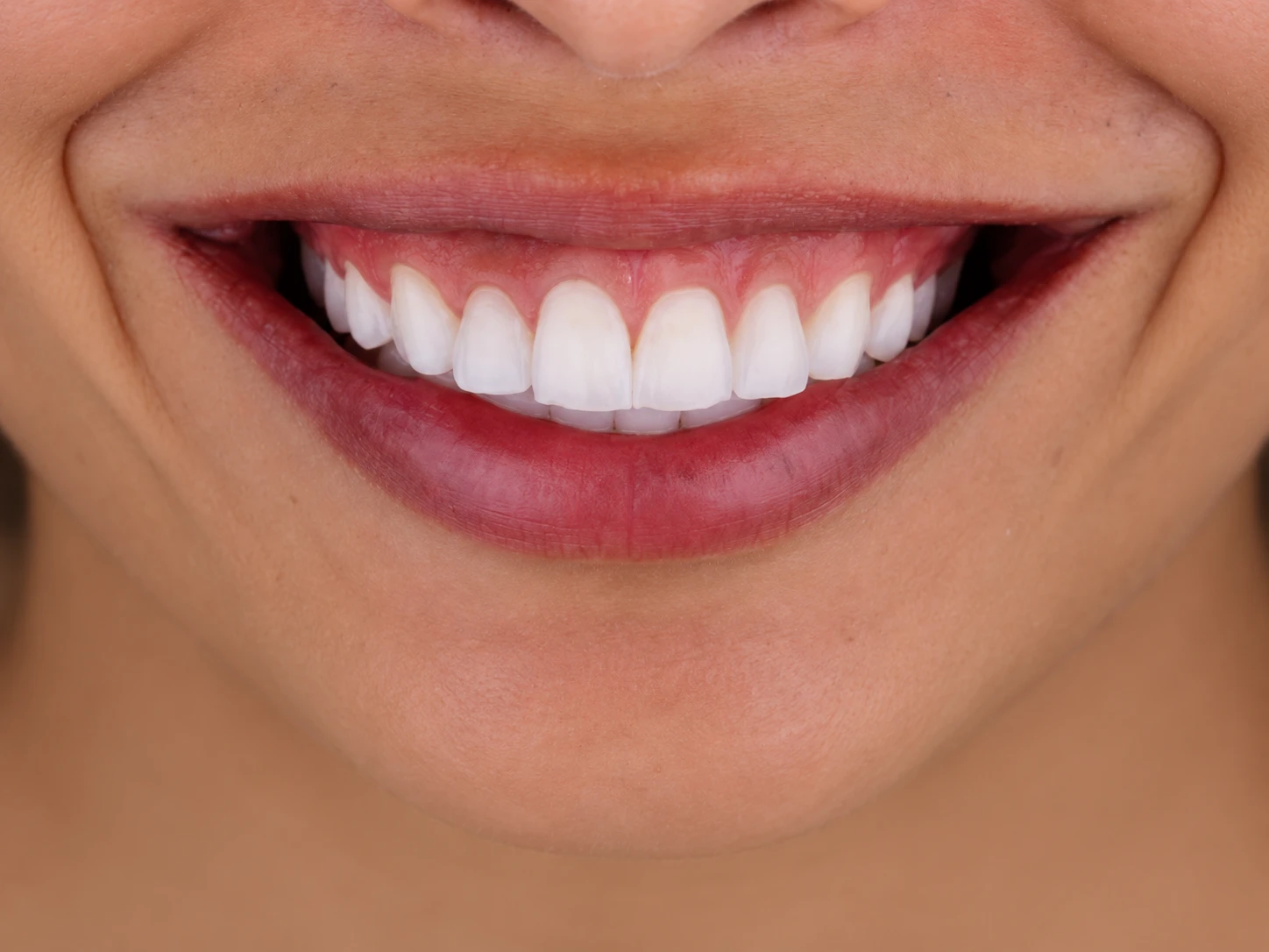 Sorriso com dentes claros, alinhados e harmônicos